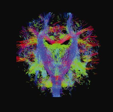 Newborn imaging facility will enable scientists to understand brain ...